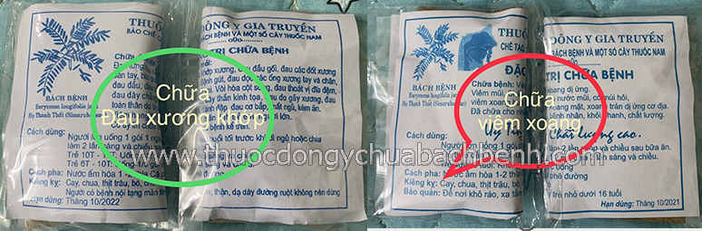 Thuốc đông y gia truyền bách bệnh chữa bệnh thoái hóa khớp ở phụ nữ